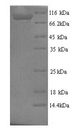 Recombinant Rat Microtubule-associated protein tau (Mapt) – Figure 1 of 1