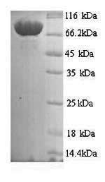 Recombinant Human Mannan-binding lectin serine protease 1 (MASP1) – Figure 1 of 1
