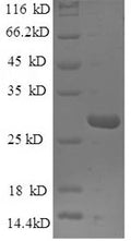 Recombinant Human Mannose-binding protein C (MBL2) – Figure 1 of 1