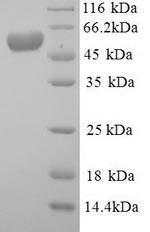 Recombinant Mouse E3 ubiquitin-protein ligase Mdm2 (Mdm2) – Figure 1 of 1