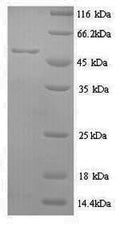 Recombinant Human Methionine aminopeptidase 2 (METAP2) – Figure 1 of 1