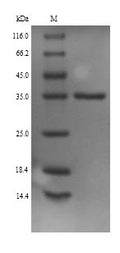 (Tris-Glycine gel) Discontinuous SDS-PAGE (reduced) with 5% enrichment gel and 15% separation gel.