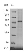 Recombinant Human Protein-methionine sulfoxide oxidase MICAL2 (MICAL2), partial – Figure 1 of 1