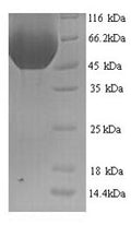 Recombinant Rat Multiple inositol polyphosphate phosphatase 1 (Minpp1) – Figure 1 of 1
