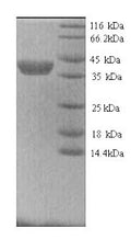 Recombinant Dog Matrix metalloproteinase-9 (MMP9) – Figure 1 of 1