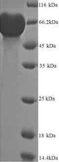 Recombinant Human Matrix metalloproteinase-9 (MMP9), partial – Figure 1 of 1