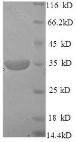 Recombinant Human DNA-3-methyladenine glycosylase (MPG), partial – Figure 1 of 1