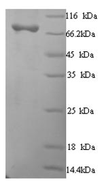 Recombinant Human Macrophage mannose receptor 1 (MRC1), partial – Figure 1 of 1