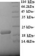 Recombinant Human B-lymphocyte antigen CD20 (MS4A1), partial – Figure 1 of 1