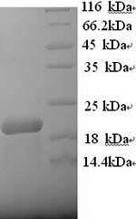 Recombinant Human B-lymphocyte antigen CD20 (MS4A1), partial – Figure 1 of 1