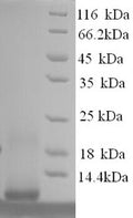 Recombinant Human Metallothionein-1F (MT1F), partial – Figure 1 of 1
