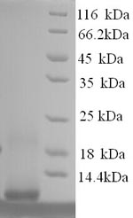 Recombinant Human Metallothionein-1F (MT1F), partial – Figure 1 of 1