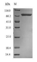 Recombinant Human Methylenetetrahydrofolate reductase (NADPH) (MTHFR) – Figure 1 of 1