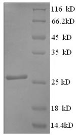 Recombinant Rat Myosin-binding protein C, cardiac-type (Mybpc3), partial – Figure 1 of 1