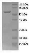 Recombinant Human N-myc proto-oncogene protein (MYCN) – Figure 1 of 1