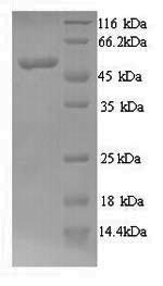 Recombinant Human N-myc proto-oncogene protein (MYCN) – Figure 1 of 1