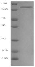 Recombinant Human Myosin-6 (MYH6), partial – Figure 1 of 1