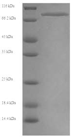 Recombinant Human Myosin-6 (MYH6), partial – Figure 1 of 1