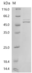 (Tris-Glycine gel) Discontinuous SDS-PAGE (reduced) with 5% enrichment gel and 15% separation gel.