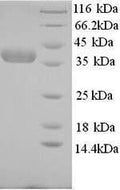 Recombinant Human Nicotinate phosphoribosyltransferase (NAPRT), partial – Figure 1 of 1