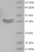 (Tris-Glycine gel) Discontinuous SDS-PAGE (reduced) with 5% enrichment gel and 15% separation gel.