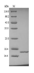 Recombinant Human NHP2-like protein 1 (NHP2L1) – Figure 1 of 1