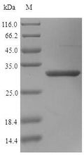 Recombinant Human Mimecan (OGN) – Figure 1 of 1