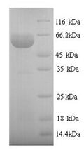 Recombinant Human Protein disulfide-isomerase (P4hb) – Figure 1 of 1