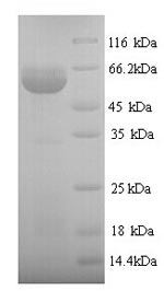 Recombinant Human Protein disulfide-isomerase (P4hb) – Figure 1 of 1