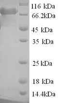 Recombinant Human Poly (A)-specific ribonuclease PARN (PARN) – Figure 1 of 1
