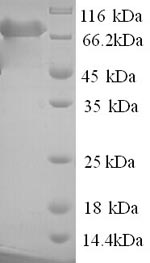 Recombinant Human Poly (A)-specific ribonuclease PARN (PARN) – Figure 1 of 1