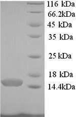 Recombinant Human Pterin-4-alpha-carbinolamine dehydRatase (PCBD1) – Figure 1 of 1