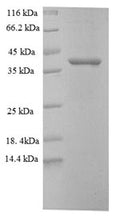 Recombinant Mouse Proprotein convertase subtilisin/kexin type 5 (Pcsk5), partial – Figure 1 of 1