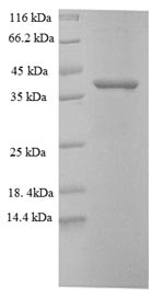 Recombinant Mouse Proprotein convertase subtilisin/kexin type 5 (Pcsk5), partial – Figure 1 of 1