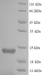 Recombinant Staphylococcus aureus Peptide deformylase (def) – Figure 1 of 1