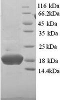 Recombinant Human 14KDA phosphohistidine phosphatase (PHPT1) – Figure 1 of 1