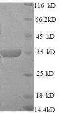 Recombinant Mouse Pituitary homeobox 3 (Pdia2) – Figure 1 of 1