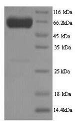 Recombinant Human Pyruvate kinase PKLR (PKLR) – Figure 1 of 1