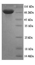 Recombinant Rat Pyruvate kinase PKLR (Pklr) – Figure 1 of 1
