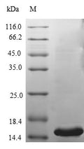 Recombinant Human Phospholipase A2 group V (PLA2G5) – Figure 1 of 1