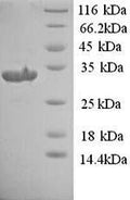 Recombinant Rat Urokinase plasminogen activator surface receptor (Plaur) – Figure 1 of 1