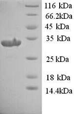 Recombinant Rat Urokinase plasminogen activator surface receptor (Plaur) – Figure 1 of 1