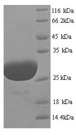 Recombinant Human Phospholamban (PLN) – Figure 1 of 1