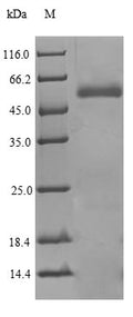 Recombinant Human Phospholipid transfer protein (PLTP) – Figure 1 of 1