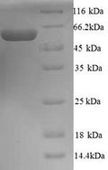 Recombinant Human Melanoma antigen preferentially expressed in tumors (PRAME) – Figure 1 of 1