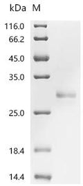 (Tris-Glycine gel) Discontinuous SDS-PAGE (reduced) with 5% enrichment gel and 15% separation gel.