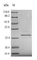 Recombinant Pig Prolactin (PRL) – Figure 1 of 1
