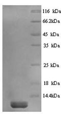 Recombinant Guinea pig Saposin-C (PSAP) – Figure 1 of 1
