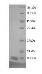Recombinant Mouse Prostate stem cell antigen (Psca) – Figure 1 of 1