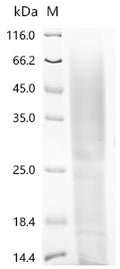 (Tris-Glycine gel) Discontinuous SDS-PAGE (reduced) with 5% enrichment gel and 15% separation gel.